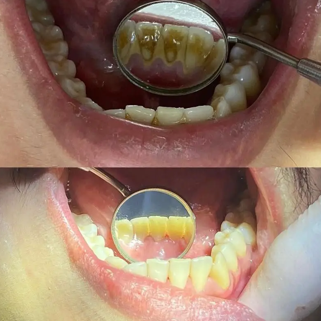 paciente4-dentista-24horas-laurodefreitas